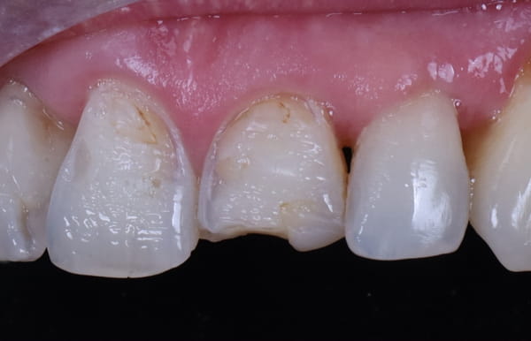 face - haymarketdentalnew