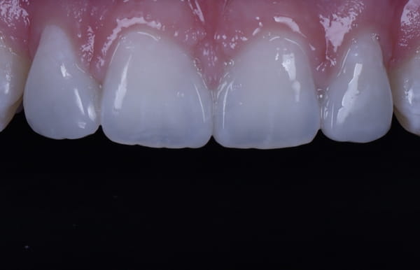 face - haymarketdentalnew