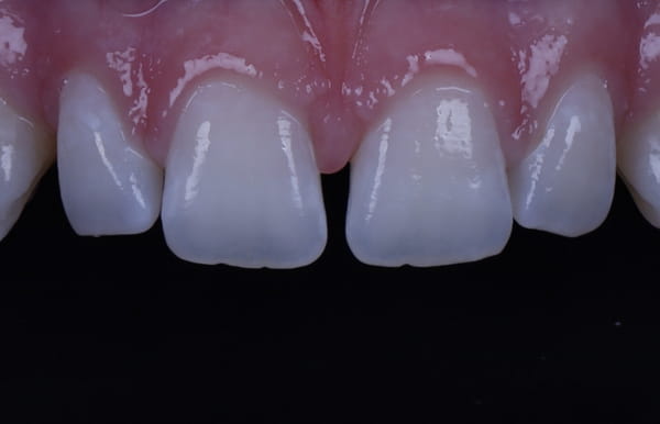 face - haymarketdentalnew